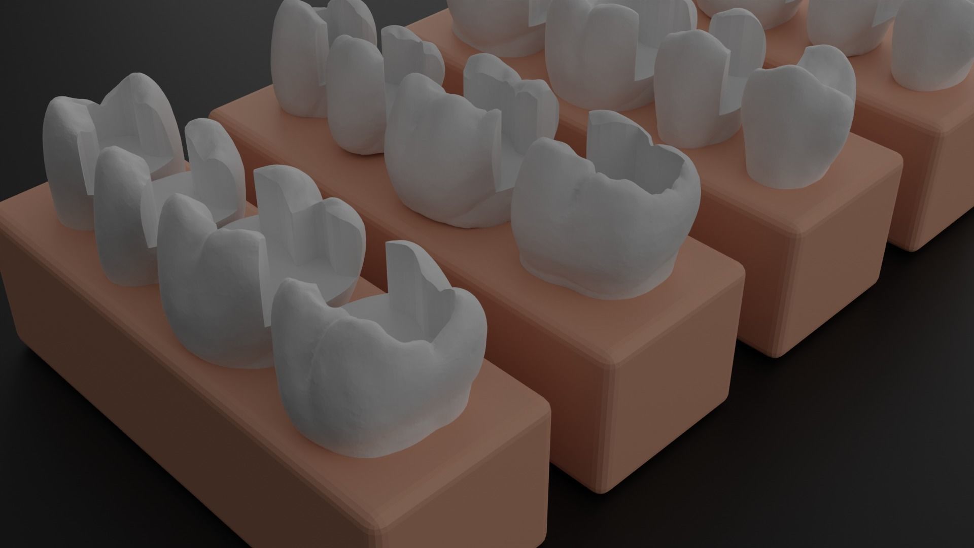 Platform teeth for students 3D print model_9