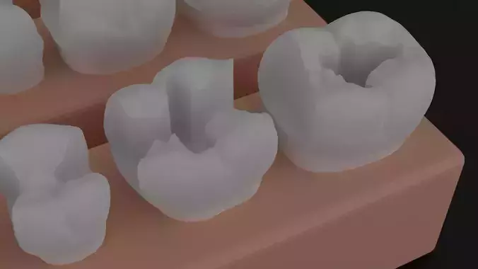 Platform teeth for students 3D print model