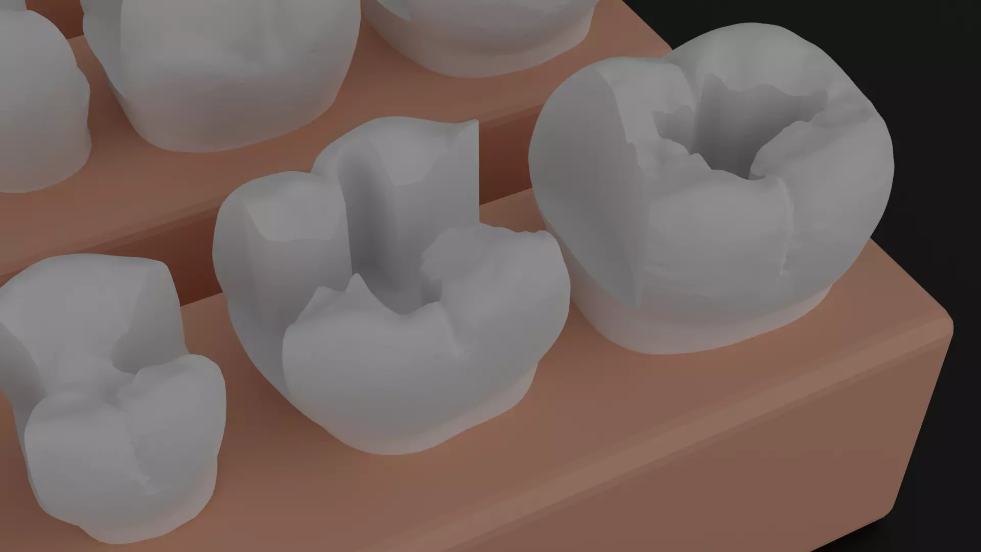 Platform teeth for students 3D print model_0