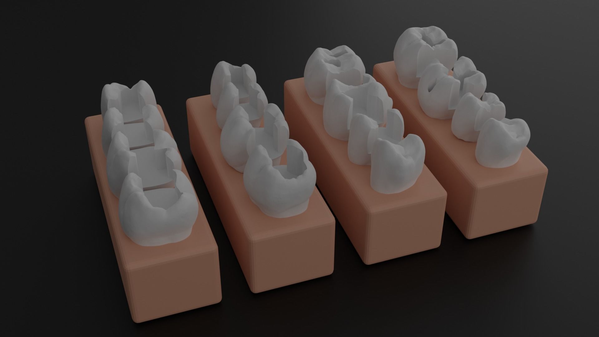 Platform teeth for students 3D print model_11