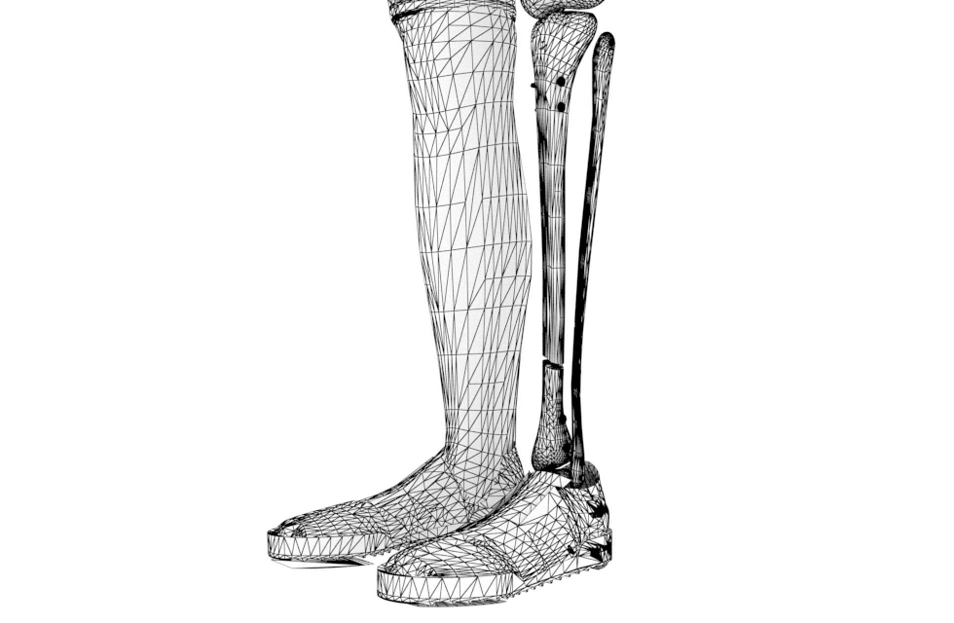 Tibial Intramedullary Nail 3D model_17