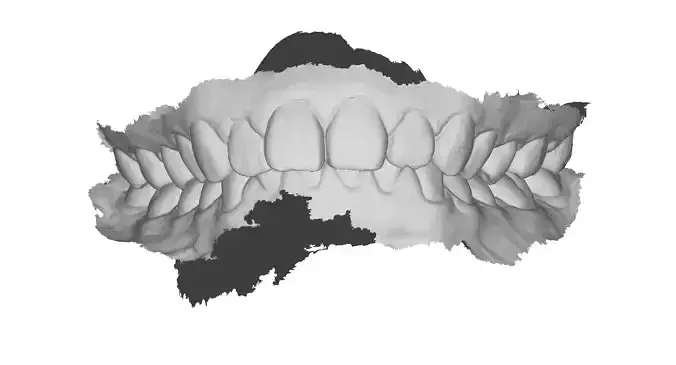 P001 - Dental - Intraoral Scan STL-PLY-OBJ