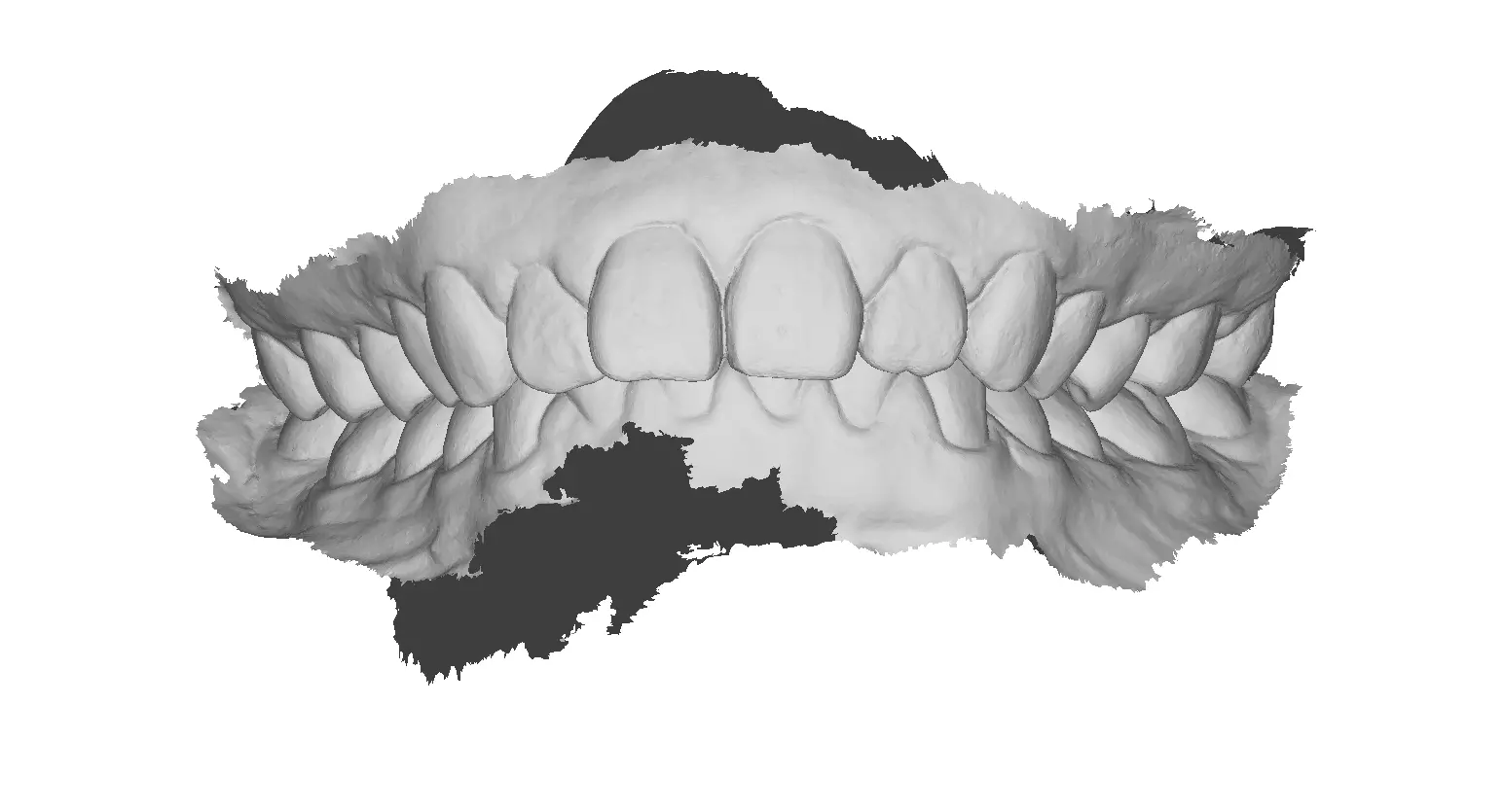P001 - Dental - Intraoral Scan STL-PLY-OBJ 3D print model