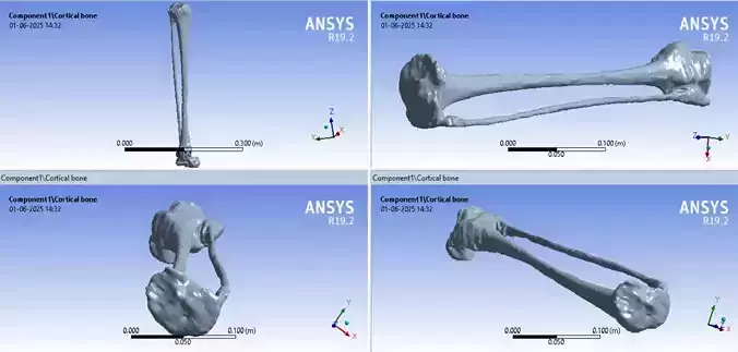 Tibia Fibula with Talus 3D model for FEA and 3d printing