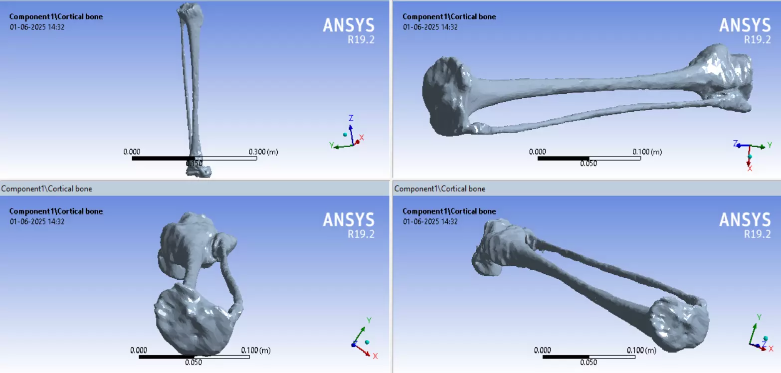 Tibia Fibula with Talus 3D model for FEA and 3d printing 3D print model