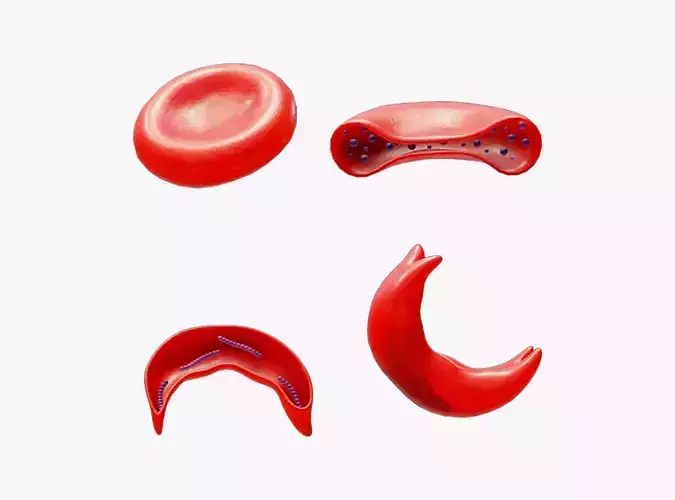 Cross Section of Normal vs Sickle Red Blood Cell 3D model