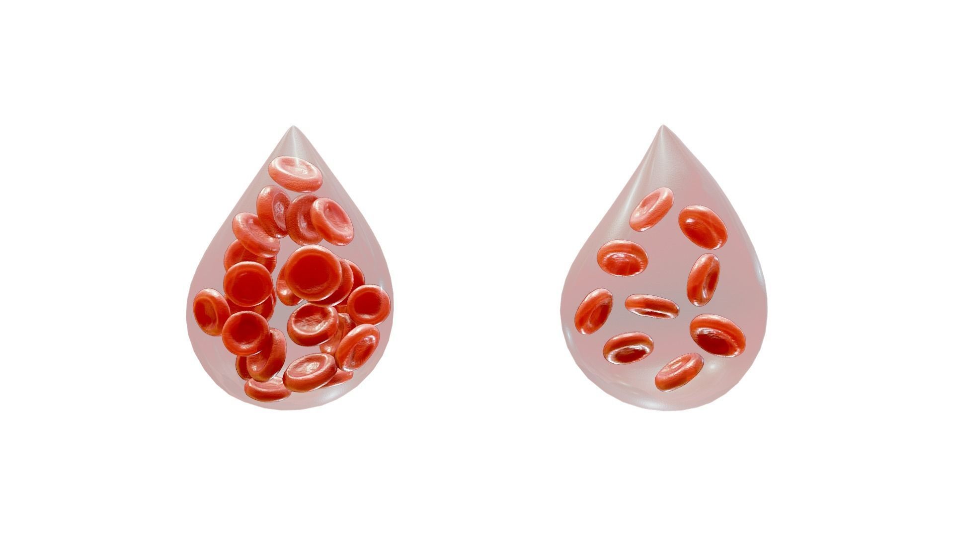 Normal Blood Cells vs Anemia 3D model_3