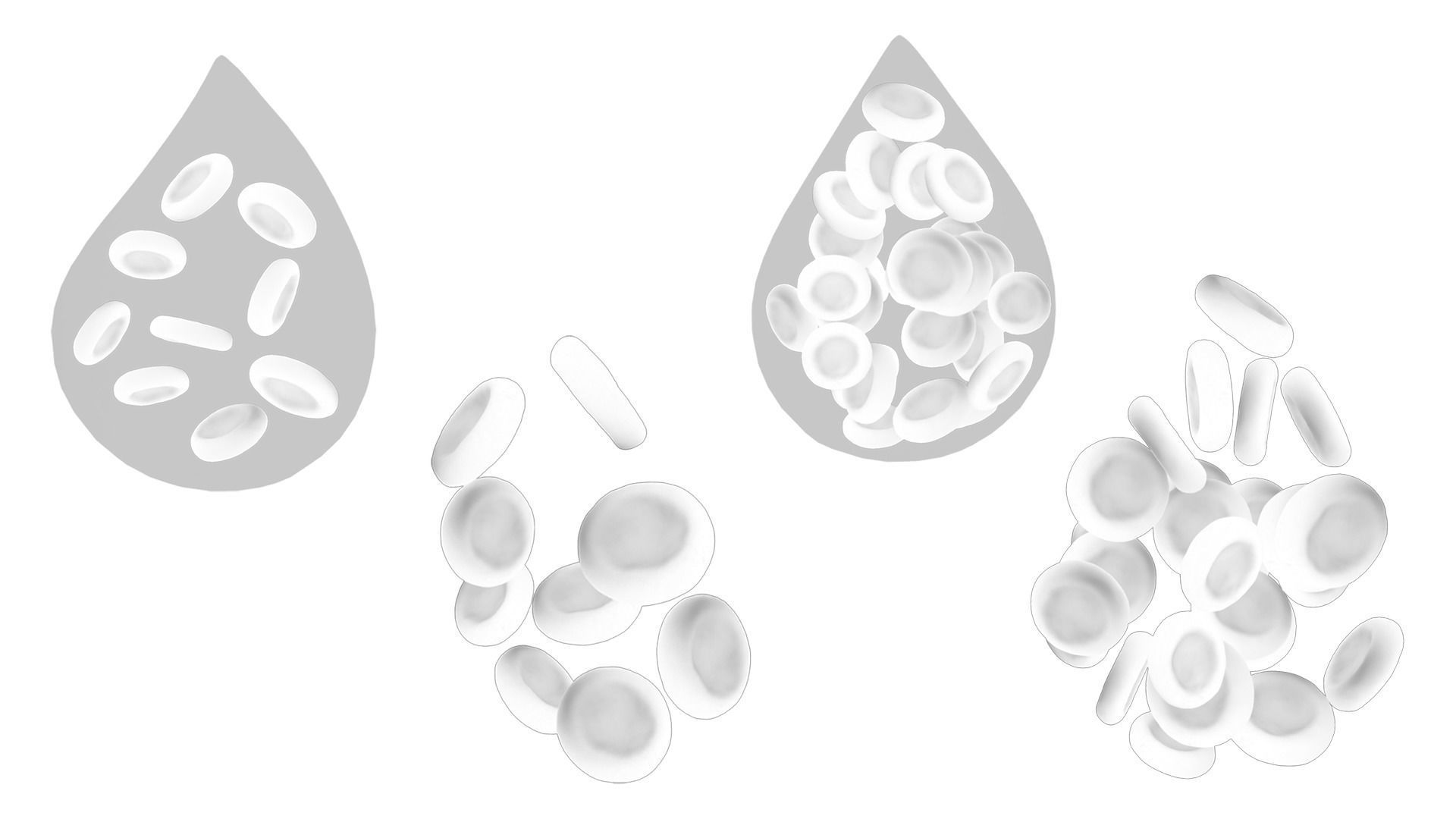 Normal Blood Cells vs Anemia 3D model_6