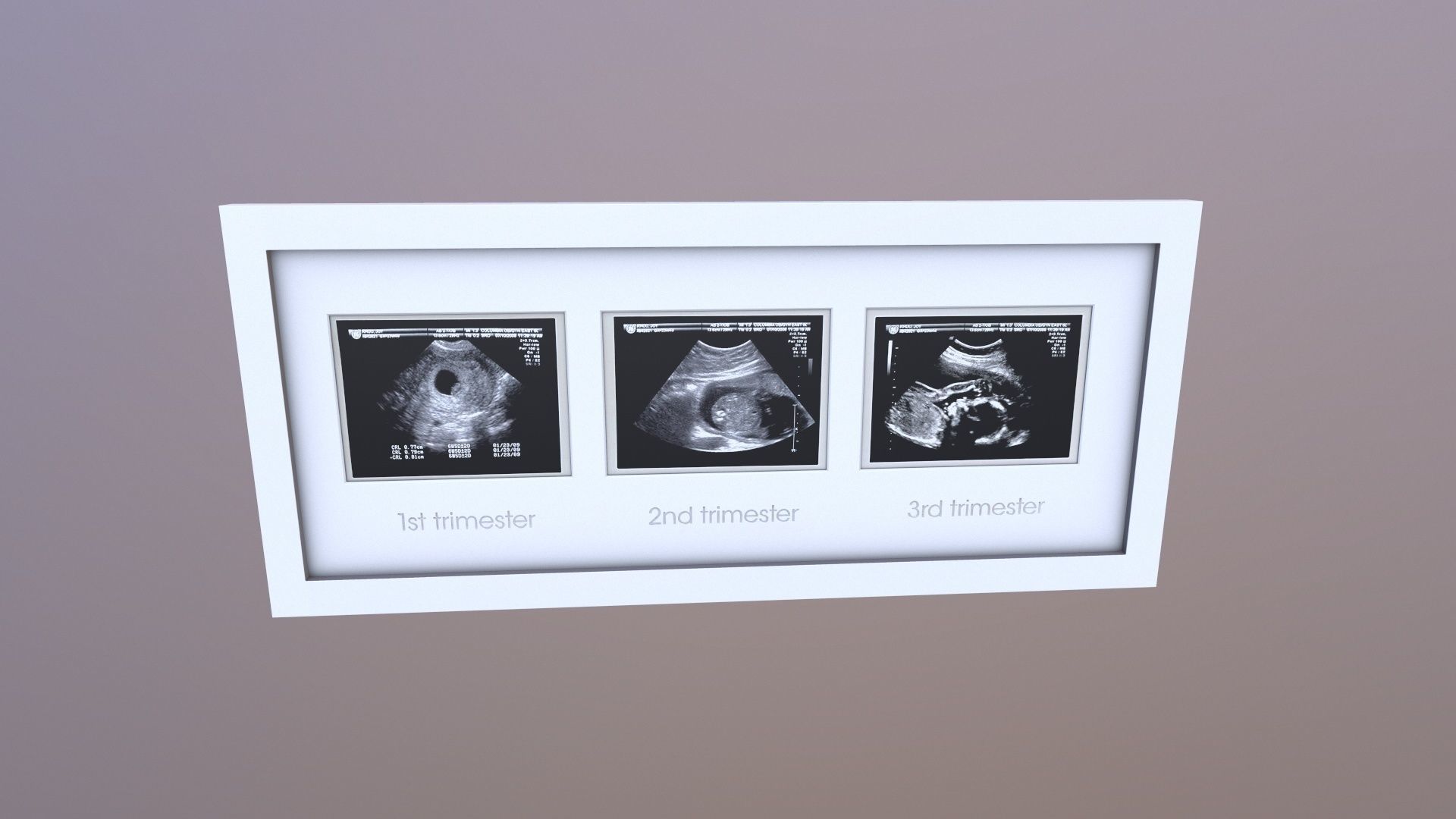 Pregnancy Frame Baby Scan Photo Frame 3D model_4