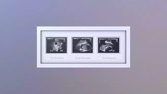 Pregnancy Frame Baby Scan Photo Frame 3D model