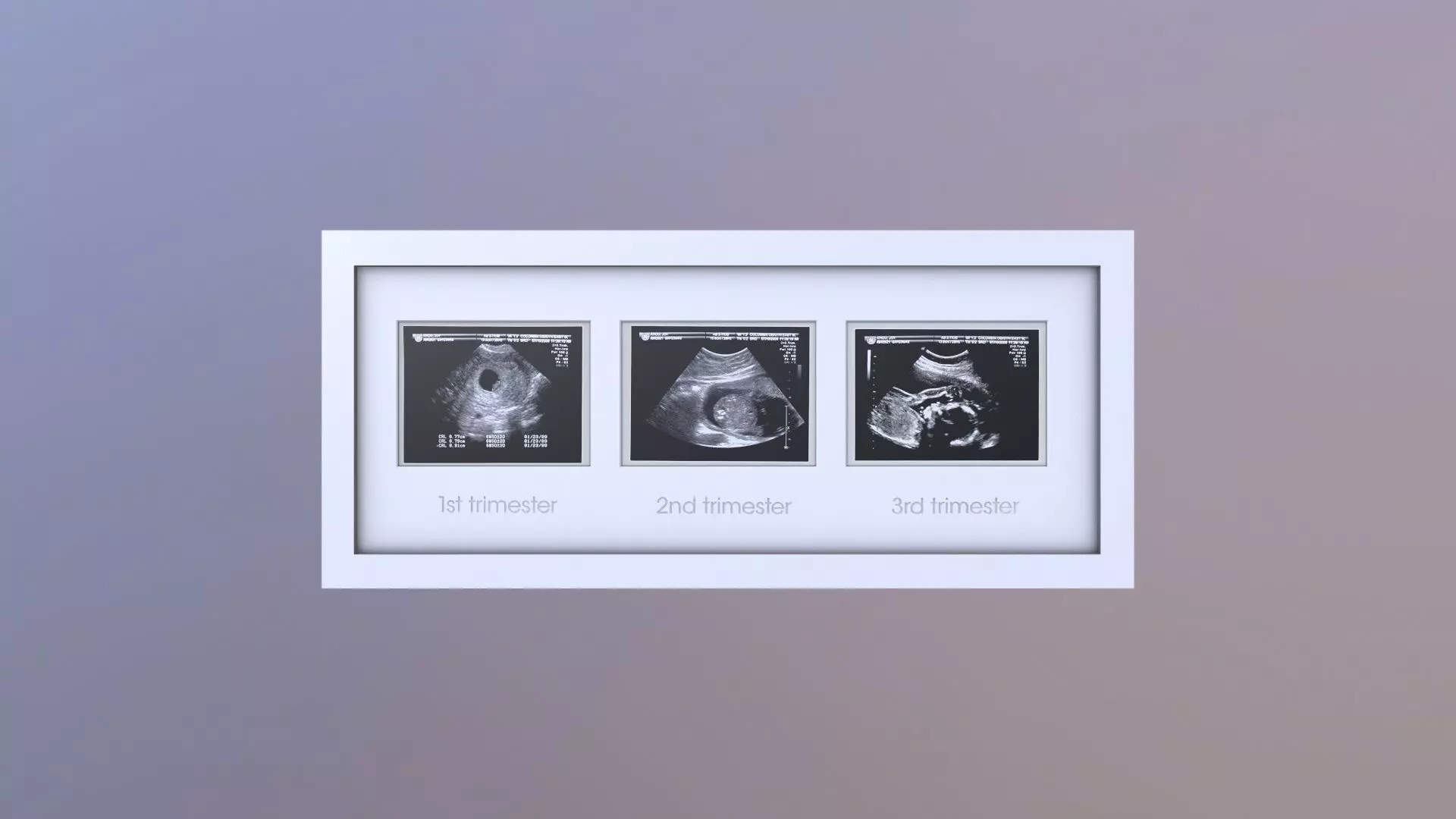 Pregnancy Frame Baby Scan Photo Frame 3D model_0