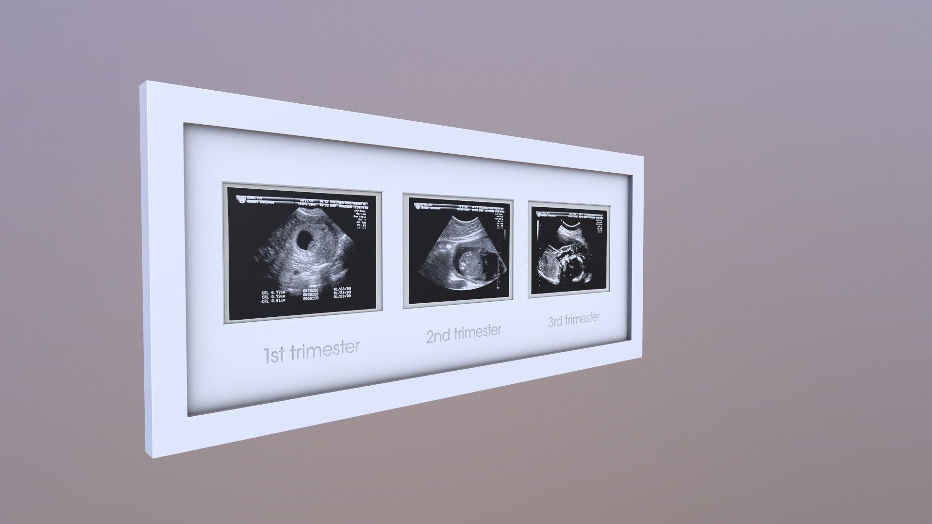 Pregnancy Frame Baby Scan Photo Frame 3D model_2