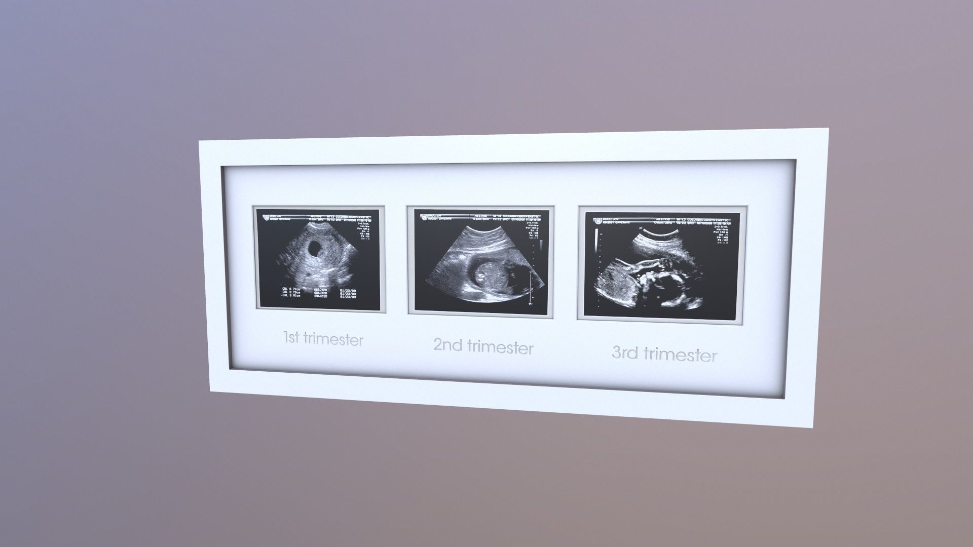 Pregnancy Frame Baby Scan Photo Frame 3D model_3