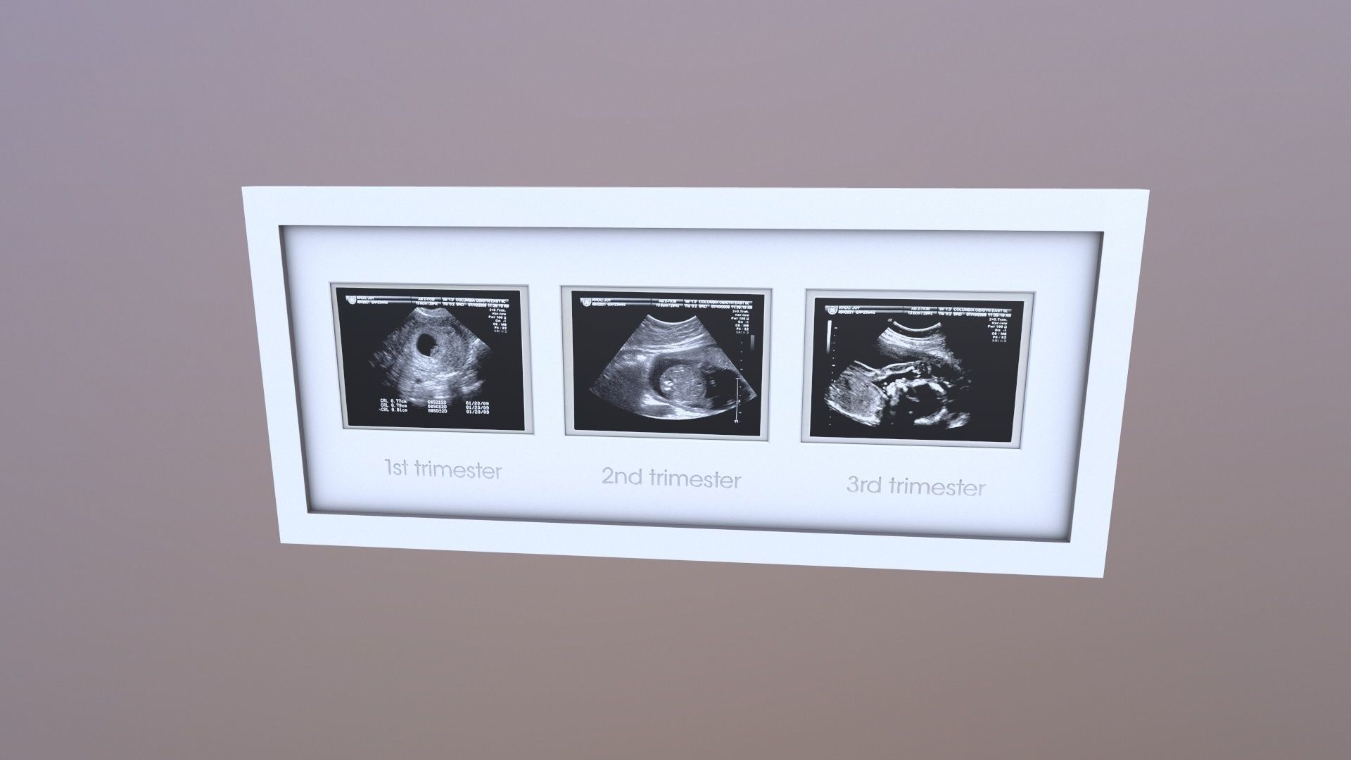 Pregnancy Frame Baby Scan Photo Frame 3D model_7