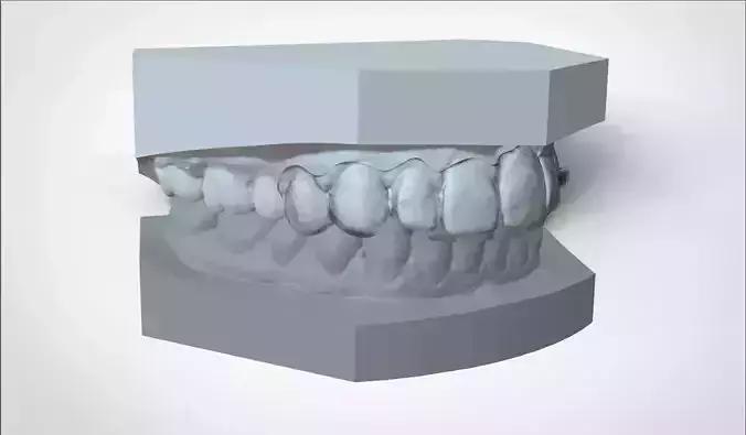 Digital Ortho Mini Deprogrammer Splint 3D print model