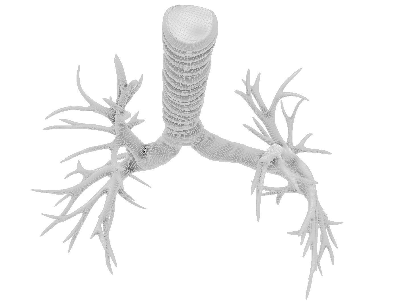Printable Bronchial Tree 3D print model_4
