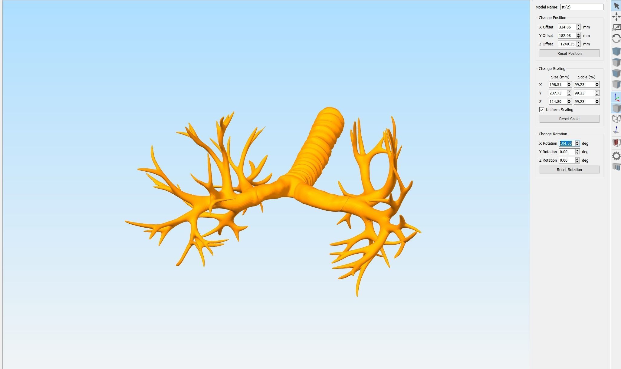 Printable Bronchial Tree 3D print model_3