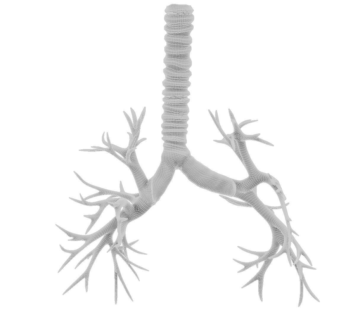 Printable Bronchial Tree 3D print model_2