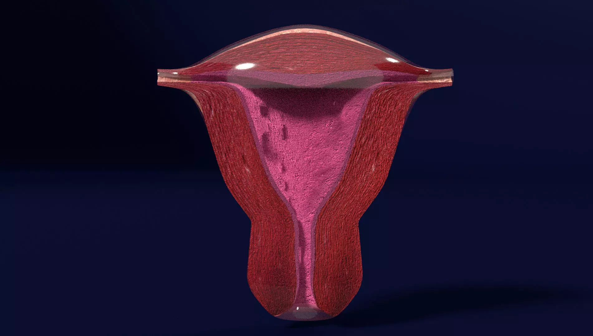 Uterus cut open bisected labelled detail Low-poly 3D model_0