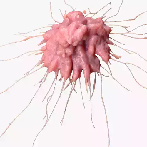 Cancer Cell Tumor