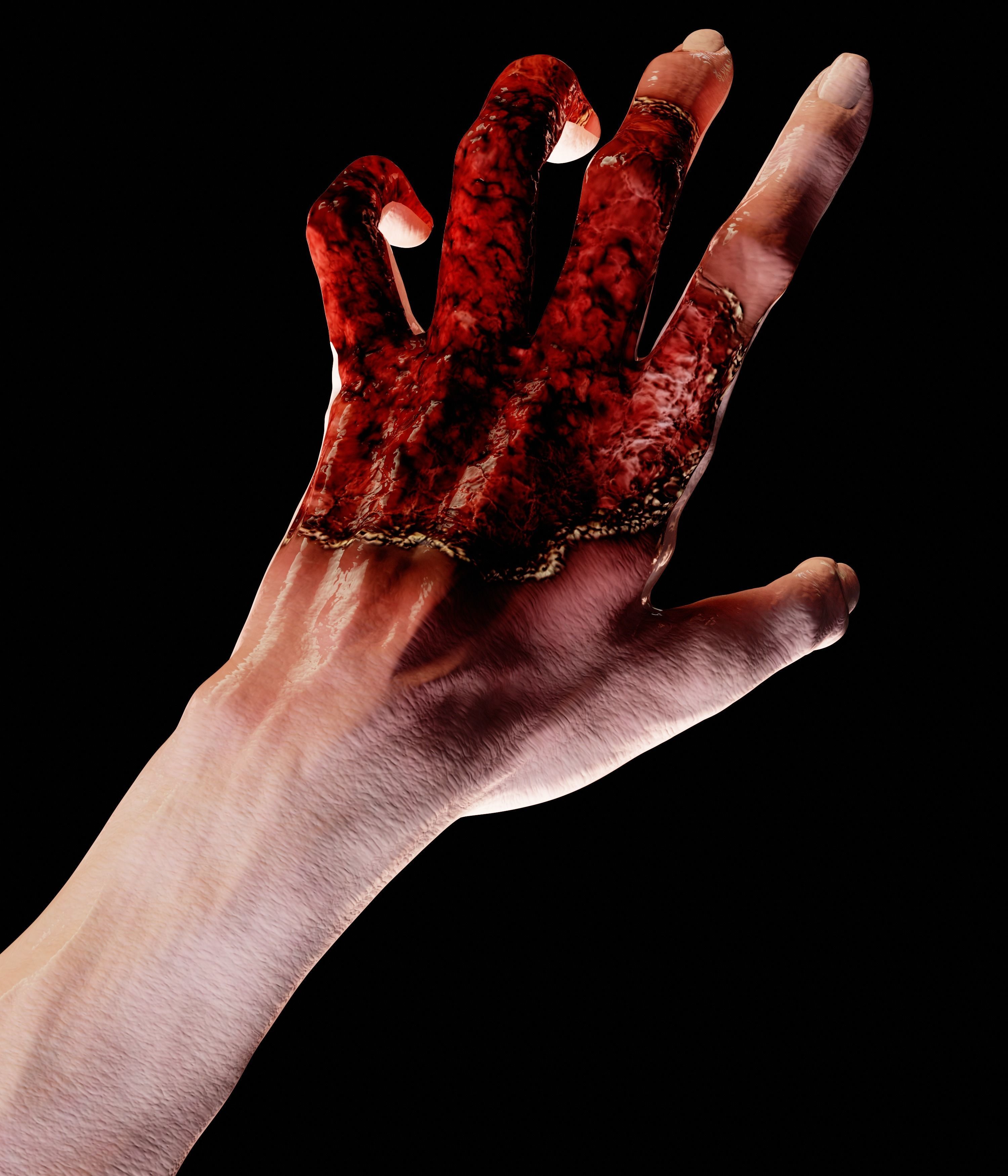 Wounded skin material  SBS -SBSR- PBR Texture_4