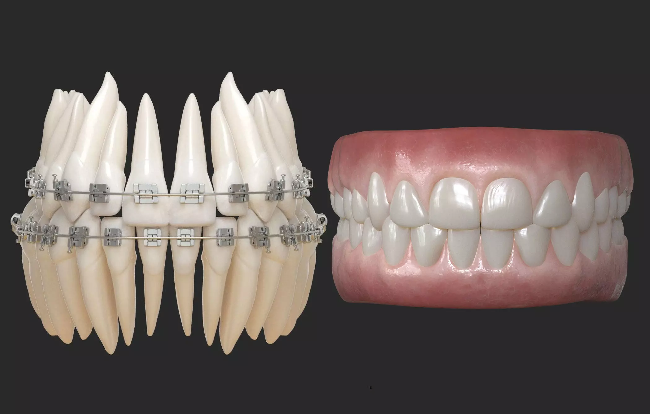 Teeth And Gums Bundle 3D Model Collection_0