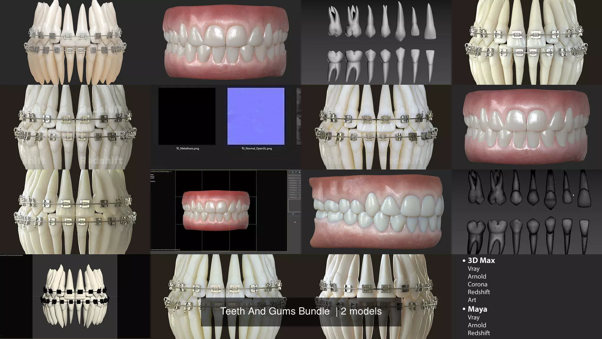 Teeth And Gums Bundle 3D Model Collection_4