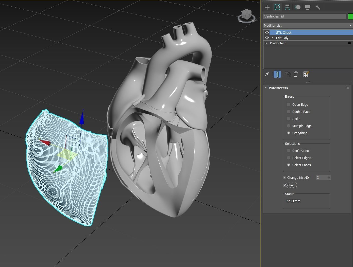 Inside Heart Anatomy - Printable 3D print model_5