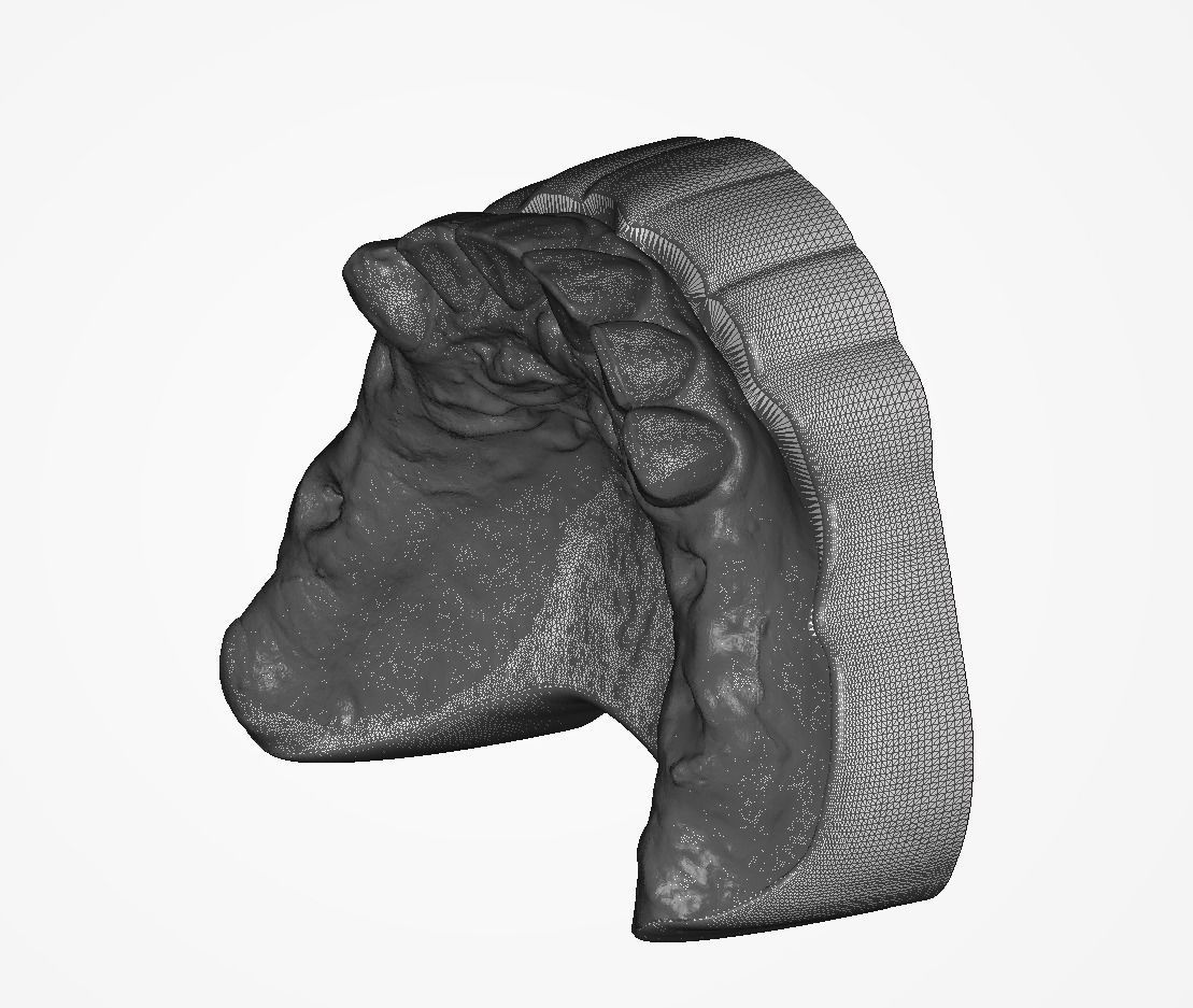 Digital RPD Model 3D print model_10