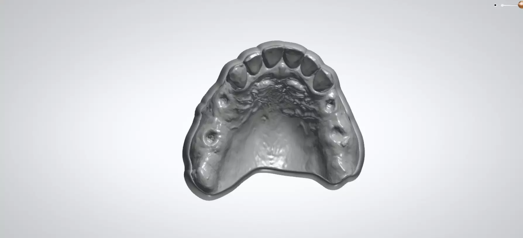 Digital RPD Model 3D print model_0