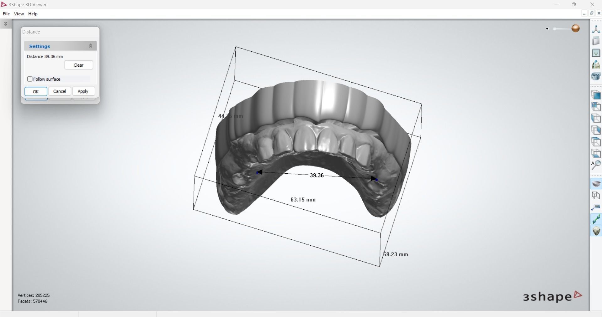 Digital RPD Model 3D print model_5