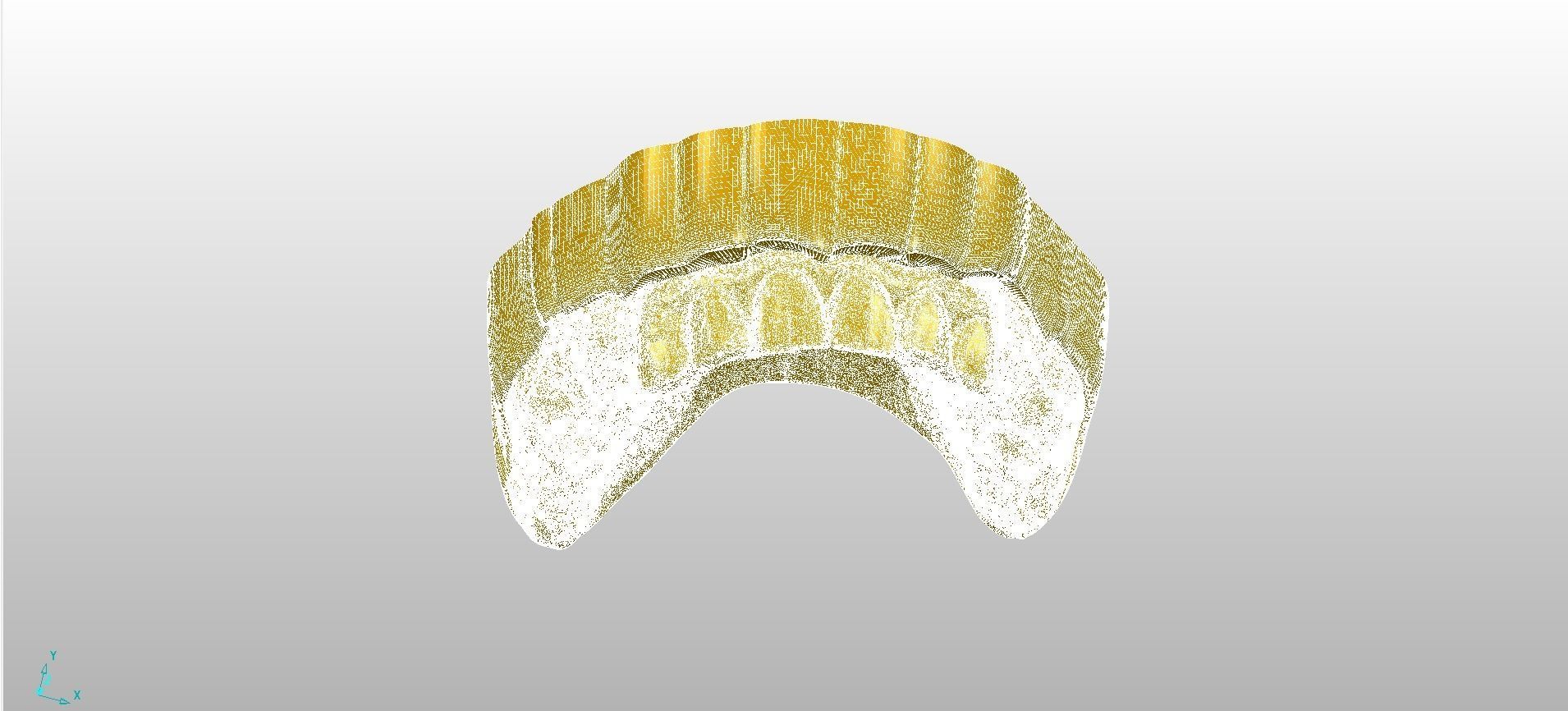 Digital RPD Model 3D print model_8