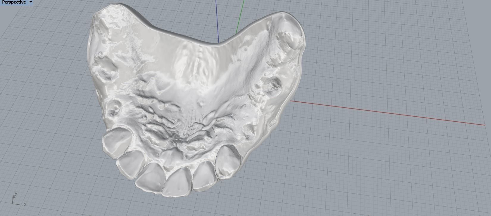 Digital RPD Model 3D print model_7