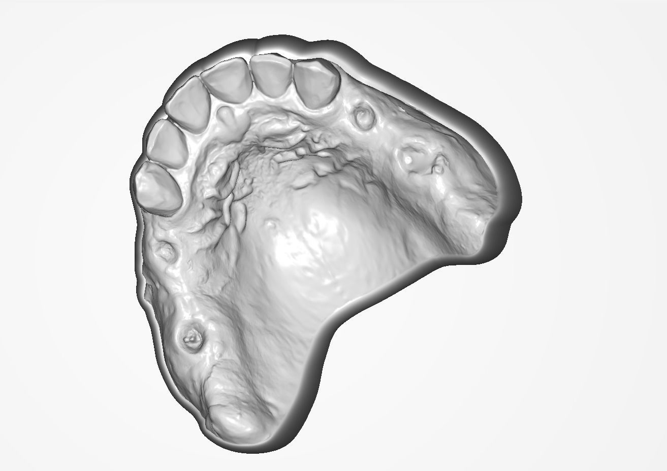 Digital RPD Model 3D print model_12