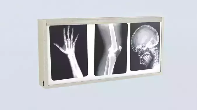 X-ray lightox