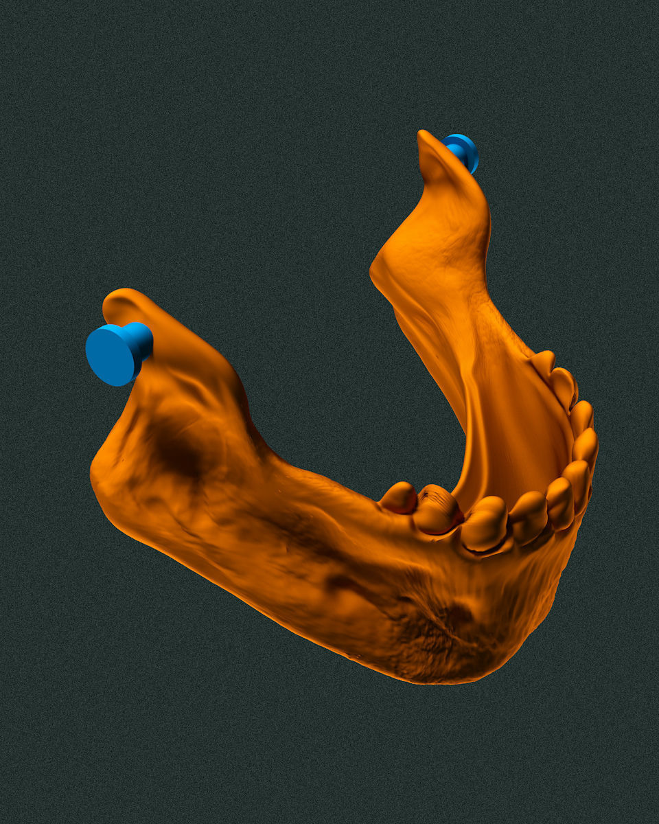 KEYCHAIN SKULL WITH ARTICULATED JAW 3D print model_4