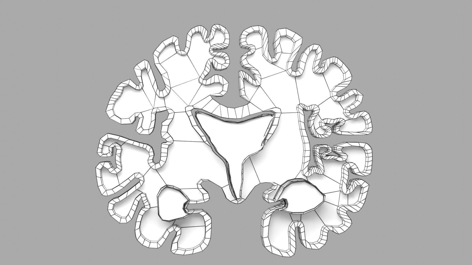 Alzheimer Disease Brain coronal slice 3D model_49
