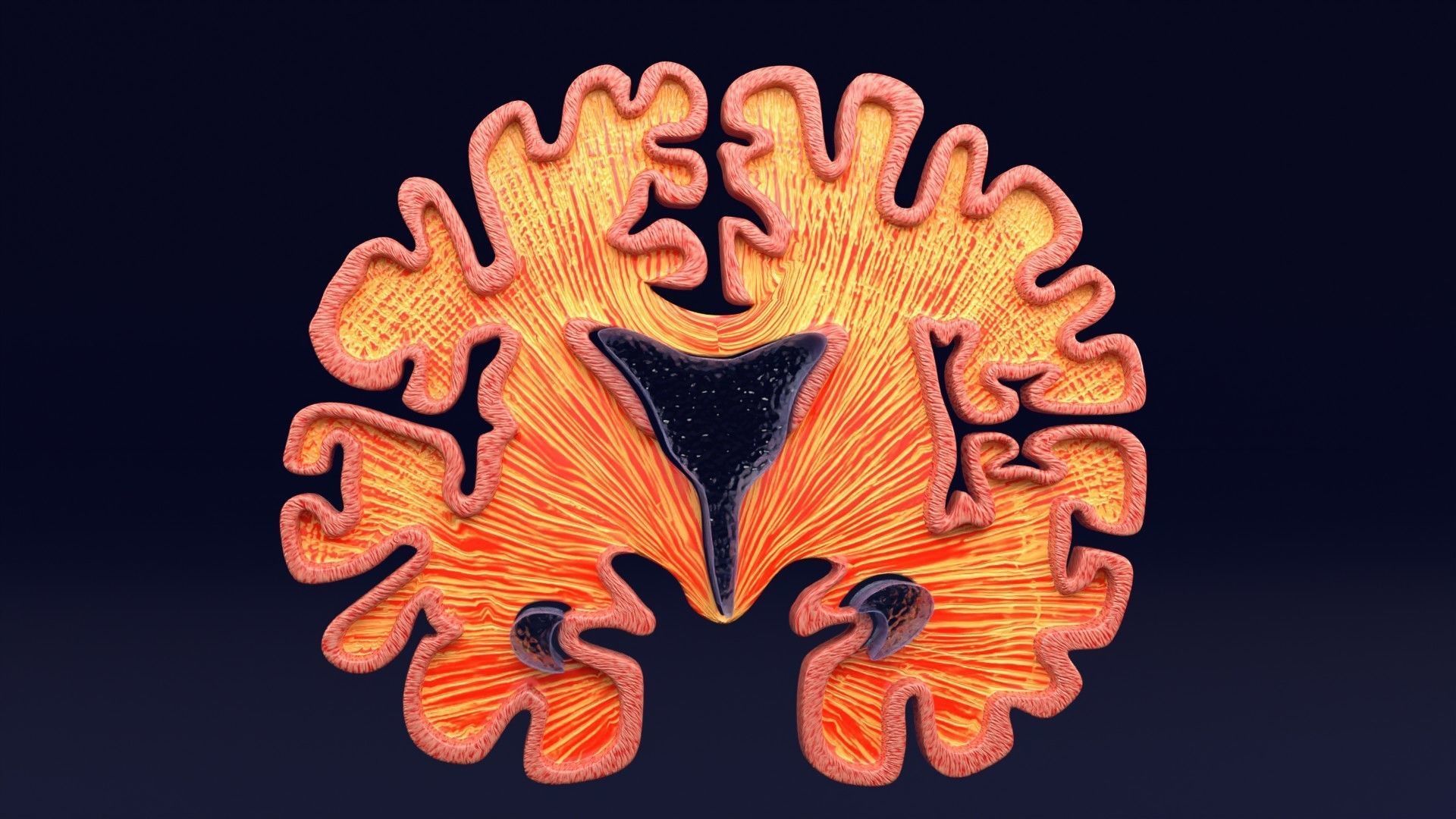 Alzheimer Disease Brain coronal slice 3D model_41