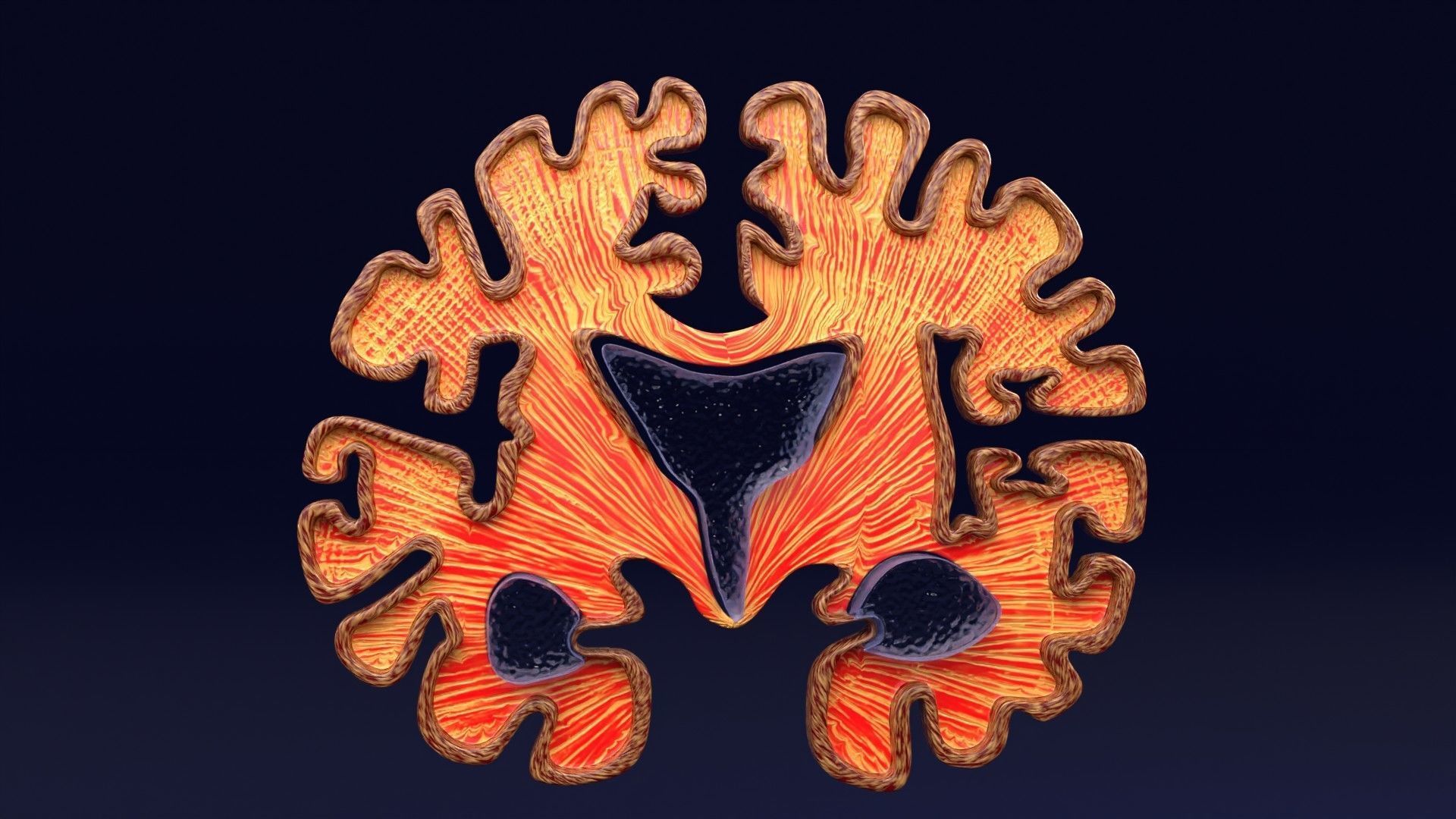 Alzheimer Disease Brain coronal slice 3D model_42
