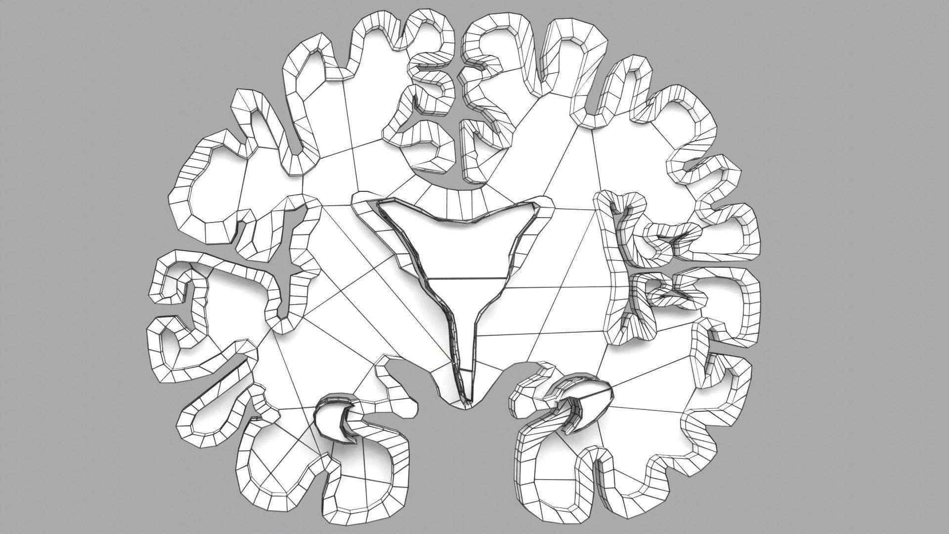 Alzheimer Disease Brain coronal slice 3D model_53