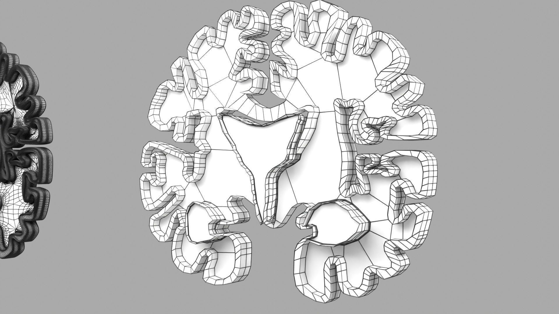 Alzheimer Disease Brain coronal slice 3D model_50