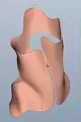 Spinal Orthosis 3D print model
