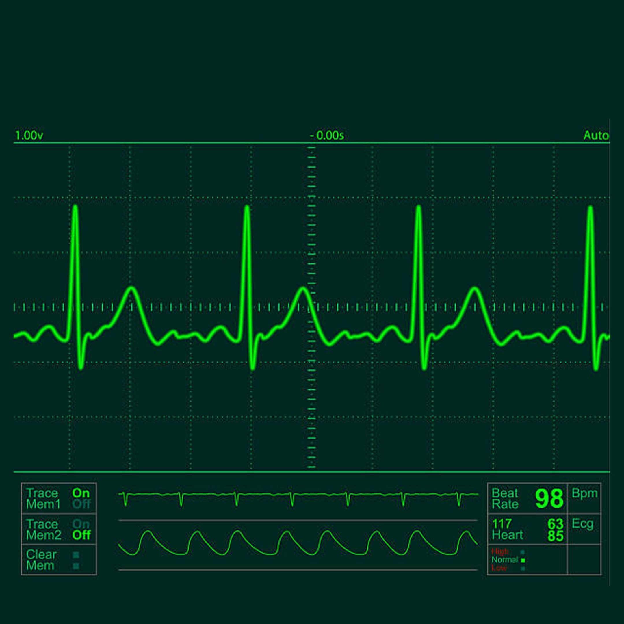 Operating Lights Low-poly 3D model_8