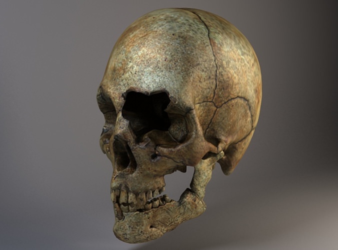 Man Skull Cracked 3D model