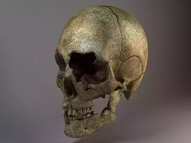 Man Skull Cracked 3D model