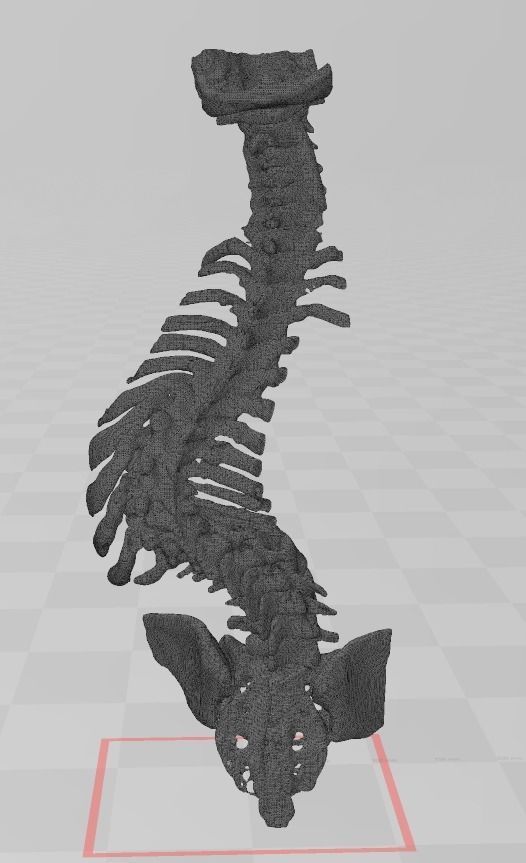 spinal cord 3D print model_4