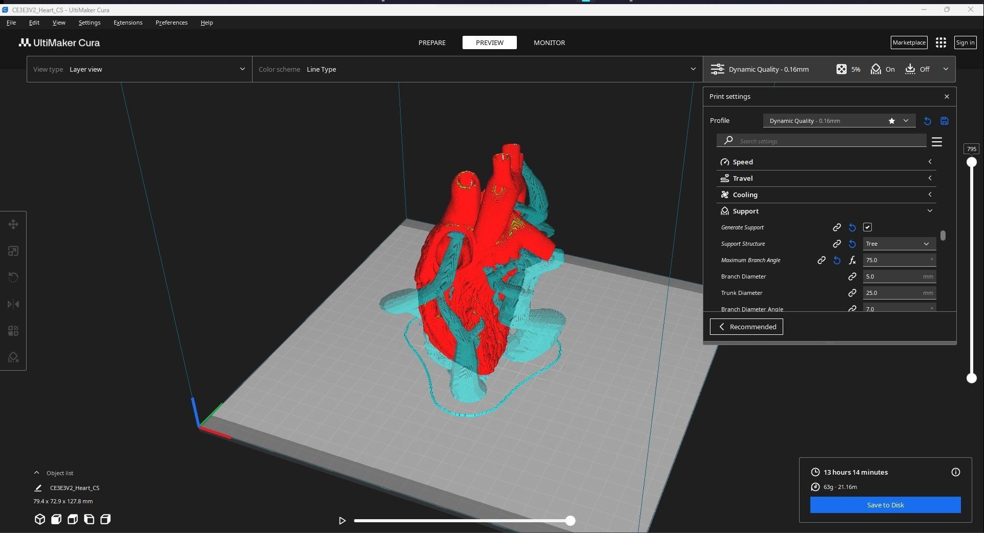HUMAN HEART CROSS SECTION 3D PRINTING 3D print model_10