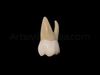 3D Model of Maxillary Left first premoler 3D model_1