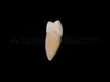 3D Model of mandibular left first premolar 3D model_1