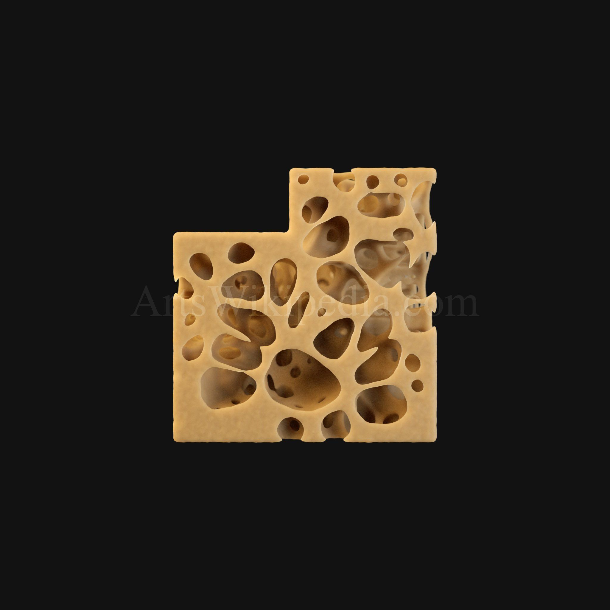 3D Normal vs Osteopenia vs Osteoporosis 3D model_1